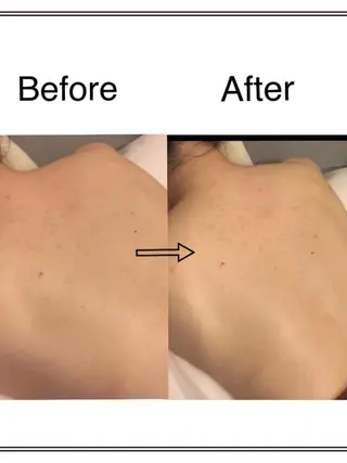 EARTH Coiffure beaute'新潟中野山所属・小池 怜香のエステ・リラクイメージ