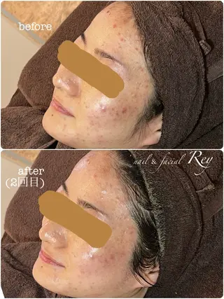 R eyのネイルデザイン