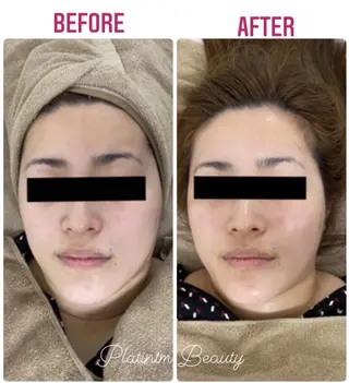 プラティーヌ ボーテのその他イメージ