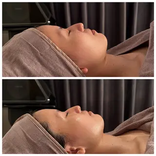 Private salon nA所属・若菜菜奈 本気の肌質改善 上島のエステ・リラクイメージ