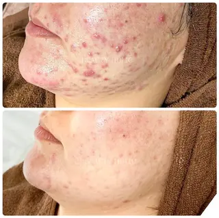 ビューティーホリック 東金店のエステ・リラクイメージ