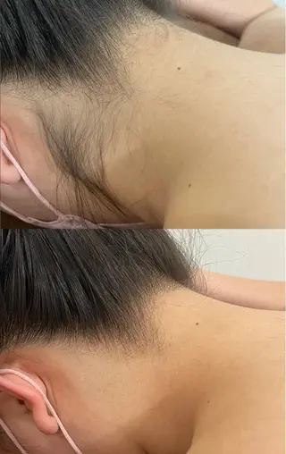 セルフエステエンリケ明石大久保店所属・夕希 毛穴と脱毛特化サロンのエステ・リラクイメージ