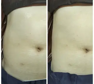 La Beaute所属・エステティックサロン La Beauteのエステ・リラクイメージ