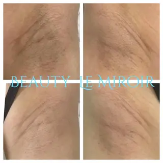 ビューティー ミロワールのエステ・リラクイメージ