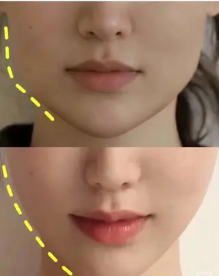 アイブロウ aliaハイフ&水光ジェットサロン所属・aliaハーブ水光店 エステティシャン募集のエステ・リラクイメージ