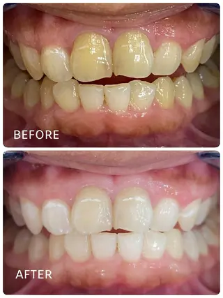 ホワイトニングサロン ラウレアのその他イメージ