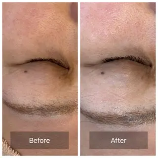 facial aesthetic salon SENTEUR所属・美肌改善/毛穴/シミ サントゥールのエステ・リラクイメージ