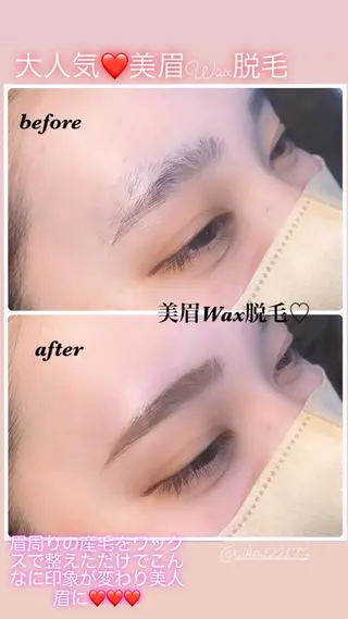 アイブロウ ハーブピーリング/韓国肌管理/フェイシャル/毛穴洗浄/眉毛/顔脱毛【糸脱毛専門】rev所属・ハーブピーリング🌹 毛穴洗浄❤️眉waxのエステ・リラクイメージ