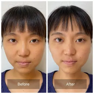 そとやまのはり おきゅう所属・外山 勝敏のエステ・リラクイメージ