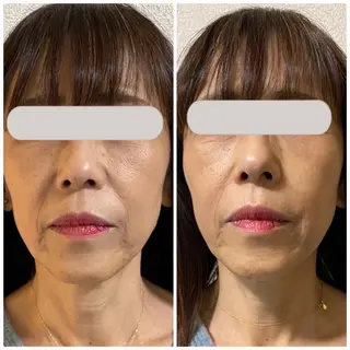 プライベートサロン Lｏｋａｈｉ飯生透のエステ・リラクイメージ