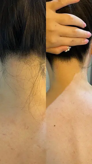 うなじ脱毛/美肌脱毛 LABELのエステ・リラクイメージ