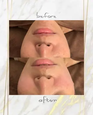 ハーブピーリング特選 認定rebirthのエステ・リラクイメージ