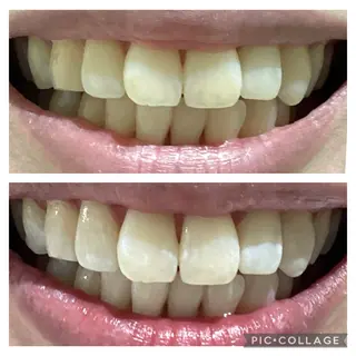 セルフホワイトニングサロン　Betee所属・セルフホワイトニング Beteeのエステ・リラクイメージ