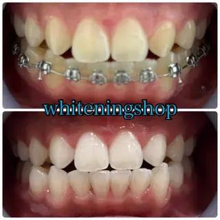 メンズ ホワイトニング ショップ川越店のエステ・リラクイメージ