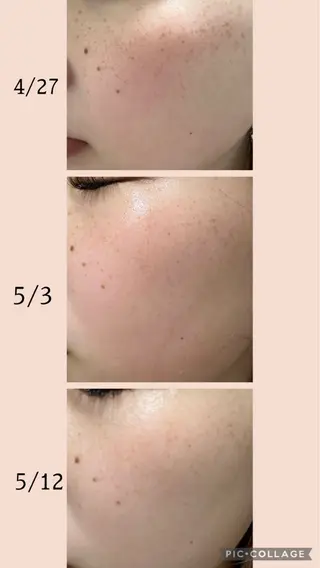 DeI'm柴田所属・【肌質改善サロン】 Harunaのネイルデザイン