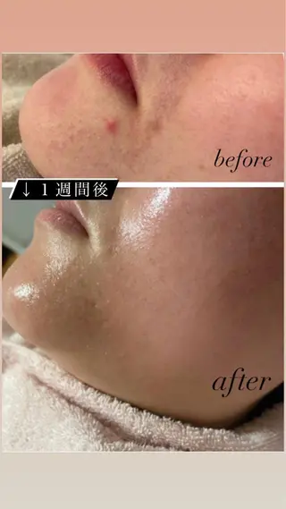 Le cherien所属・Le cherien ルシェリアのエステ・リラクイメージ