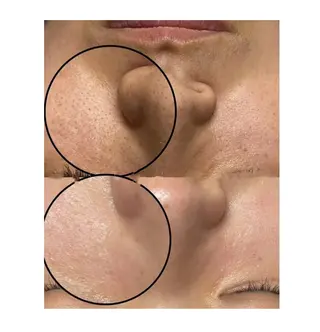 LingK/Este 中松 聖奈のエステ・リラクイメージ