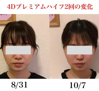 a  room salonのエステ・リラクイメージ