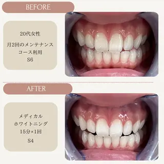 Whitening Carat 恵比寿店所属・ホワイトニング カラット 恵比寿店のエステ・リラクイメージ