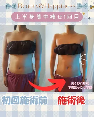 痩身ハーブピーリング 筋膜リリース☆B&Hのエステ・リラクイメージ