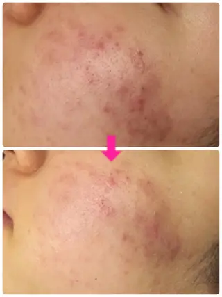 ロング カラー パーマ ヘアアレンジ メンズ キッズ ネイル マツエク・マツパ ‍痩身＆ボディ 結果出し🌟丹野のエステ・リラクイメージ