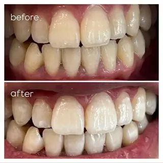 エクシア津駅前店所属・セルフホワイトニング エクシア津駅前店のその他イメージ