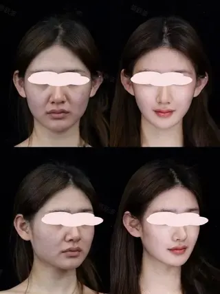 ショート aliaハイフ&水光ジェットサロン所属・aliaハーブ水光店 エステティシャン募集のエステ・リラクイメージ