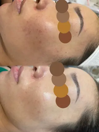 肌管理専門店 Shandeelのエステ・リラクイメージ