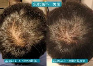 美容とカラダの鍼灸 サロン やなけんのエステ・リラクイメージ