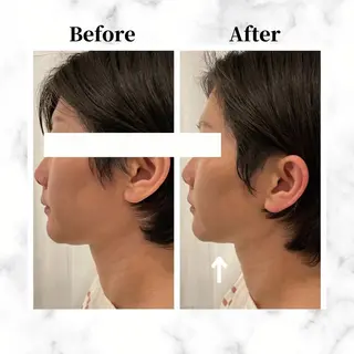 12Dハイフ💗 最強小顔のエステ・リラクイメージ