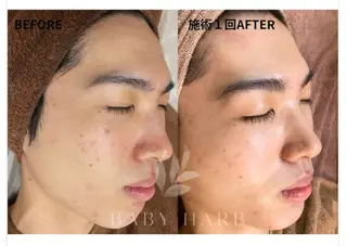 脱毛サロン&ハーブピーリングFIS大和店所属・脱毛サロン FIS大和店のエステ・リラクイメージ