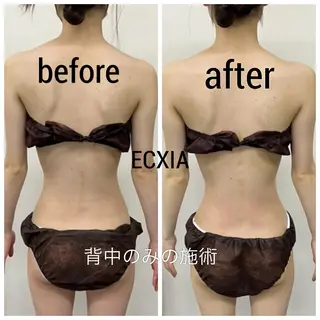 ECXIA 【エクシア】のエステ・リラクイメージ