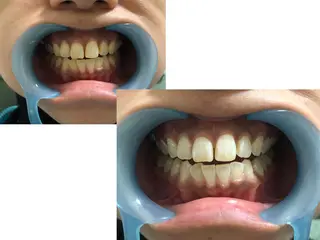 ショート ヘアアレンジ ネイル カラー メンズ マツエク・マツパ パーマ キッズ アイブロウ 中目黒 ホワイトニングサロンのその他イメージ