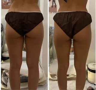 VOIR東静岡店所属・竹内 彩香のエステ・リラクイメージ