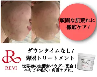 WHITE AQUA 🌼柏店のエステ・リラクイメージ