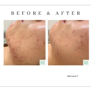 Bellmore ＋のエステ・リラクイメージ