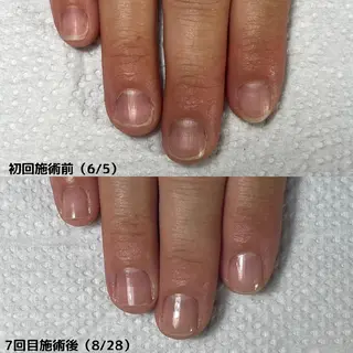 ネイル nail 1623のネイルデザイン
