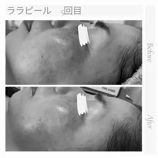 美肌脱毛と癒しのﾌﾟﾗｲﾍﾞｰﾄｻﾛﾝ。gratia~ｸﾞﾚｲﾃｨｱ~所属・gratia ~ｸﾞﾚｲﾃｨｱ~のエステ・リラクイメージ