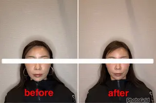 小林整骨院本町 美容鍼roomのエステ・リラクイメージ