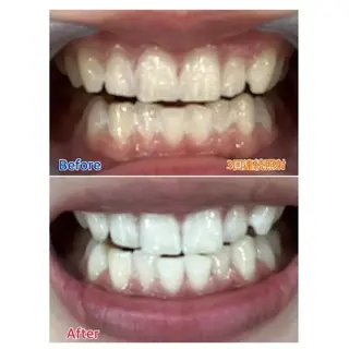 M渋谷店所属・M渋谷 ホワイトニングのその他イメージ