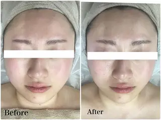 パーソナルエステ L'purのエステ・リラクイメージ