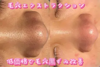 Beauty Zion所属・Beauty Zionのエステ・リラクイメージ