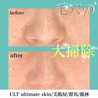 ULT ultimateskin所属・ULT ウルトのエステ・リラクイメージ