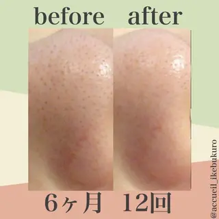 ミディアム カラー パーマ ヘアアレンジ メンズ キッズ ネイル マツエク・マツパ ニキビ・肌質改善専門 ♡人生が変わるサロンのエステ・リラクイメージ