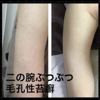 ハーブピーリング 専門店MOKA所属・ハーブピーリング専門 MOKAのエステ・リラクイメージ