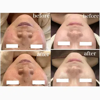 Lily branc 痩身/小顔/肌質改善のエステ・リラクイメージ