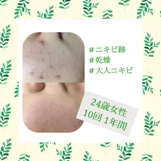 ミディアム カラー パーマ ヘアアレンジ メンズ キッズ ネイル マツエク・マツパ ニキビ・肌質改善専門 ♡人生が変わるサロンのエステ・リラクイメージ