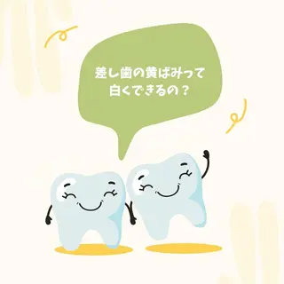歯のホワイトニング HARU南浦和のその他イメージ