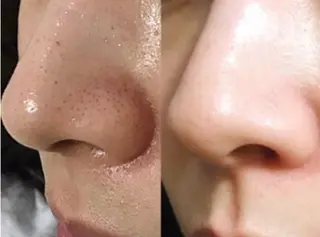 小顔矯正＆美肌サロン BUPURA岡山のエステ・リラクイメージ