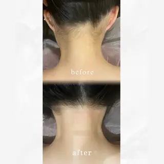 骨盤矯正フィジーク大宮所属・トータルビューティー 痩身&小顔専門店のエステ・リラクイメージ